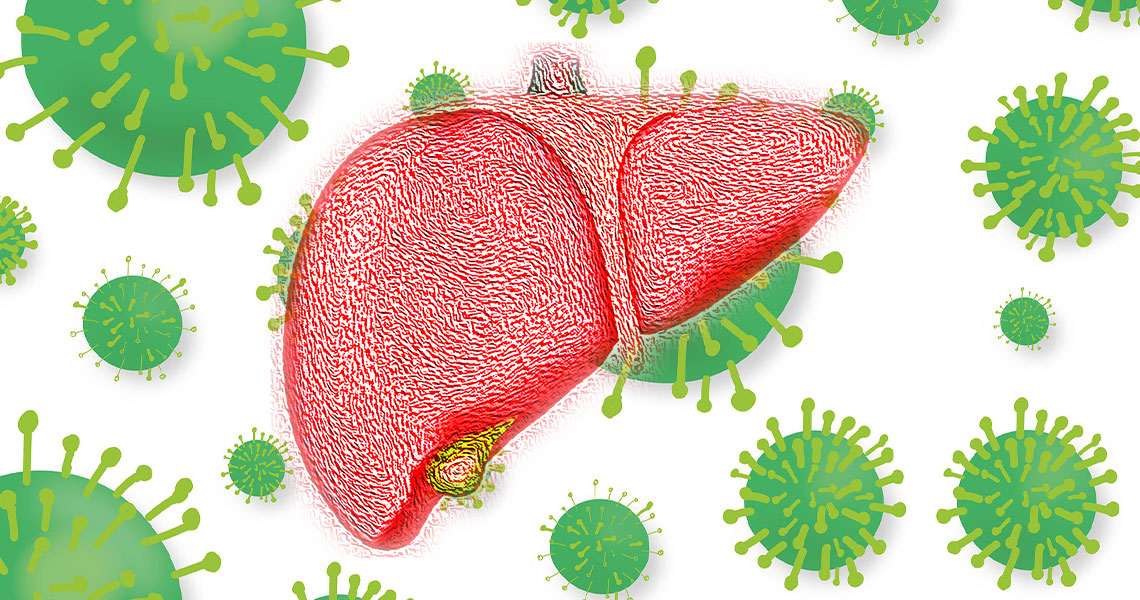 Hepatitis A and E: Causes, Symptoms, Treatment, and Prevention